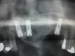 2010080411270000.jpg