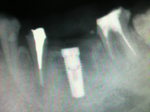 2010082110320001.jpg