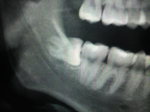 2010082412180001.jpg
