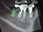 2010083010270001.jpg