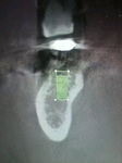 2010083010280000.jpg