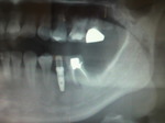 2010083011000000.jpg