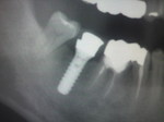 2010100612350000.jpg