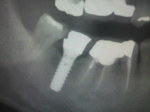 2010100612360000.jpg