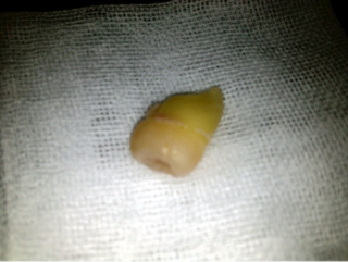image-20120625183929.png
